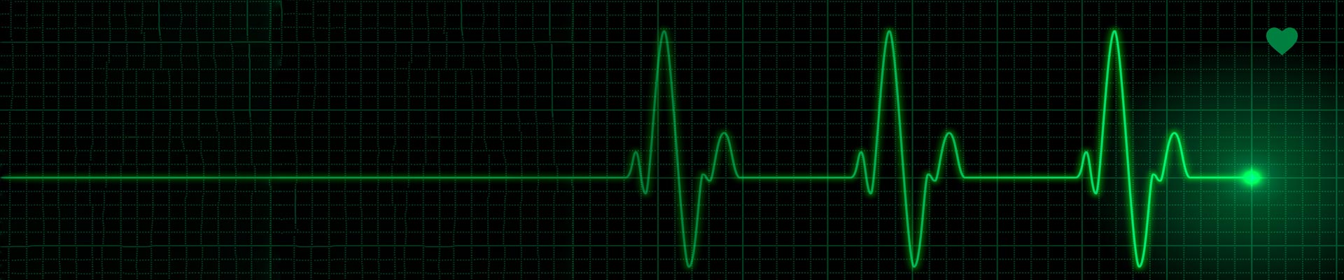 Diagnosis of Heart Rhythm Disorders
